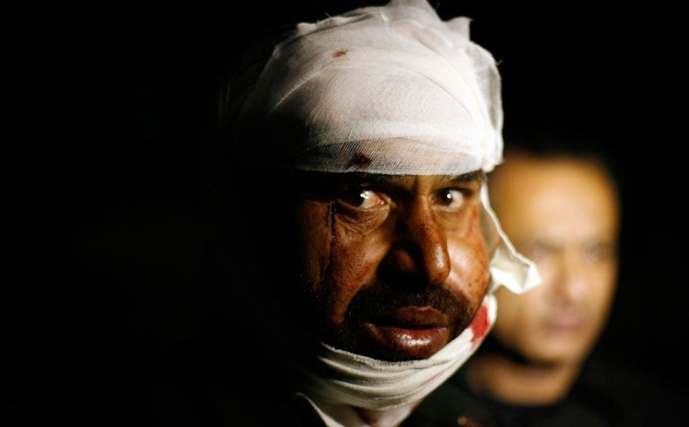 25. A Pakistani man wounded in a suicide bomb attack near Wagah border, Lahore that left at least 45 people dead - November 2, 2014.