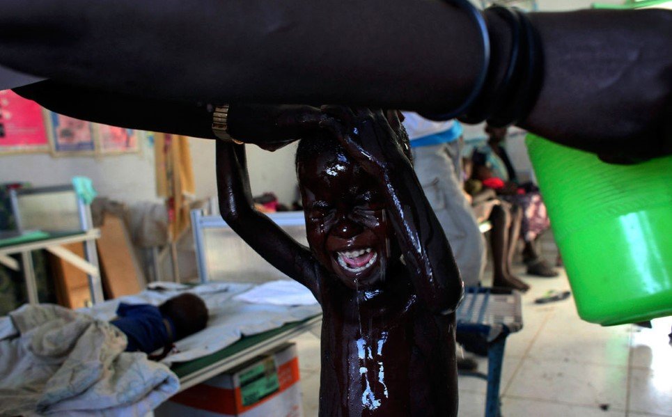 74. A malnourished South Sudanese child cries as he is being bathed by a nurse at a feeding centre in Kodok, Fashoda County - May 28, 2014.