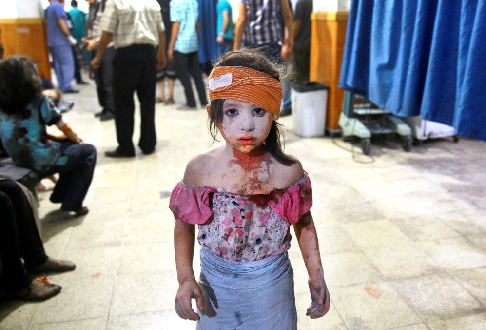 A wounded Syrian girl wanders about a makeshift hospital in the rebel-held area of Douma, following shelling and air raids by Syrian government forces – Aug. 22, 2015