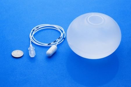Elipse Gastric Balloon aims to aid obese people to lose wieght