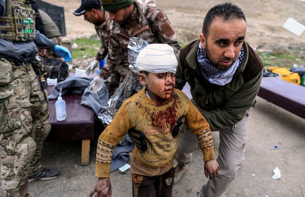 a boy injured in a mortar attack walks toward an ambulance after being treated by medics in a field clinic as iraqi forces battle with islamic state militants in western mosul iraq on march 2 2017