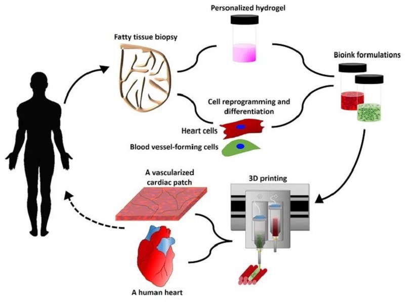 World's First 3D Printed Heart Tel Aviv University