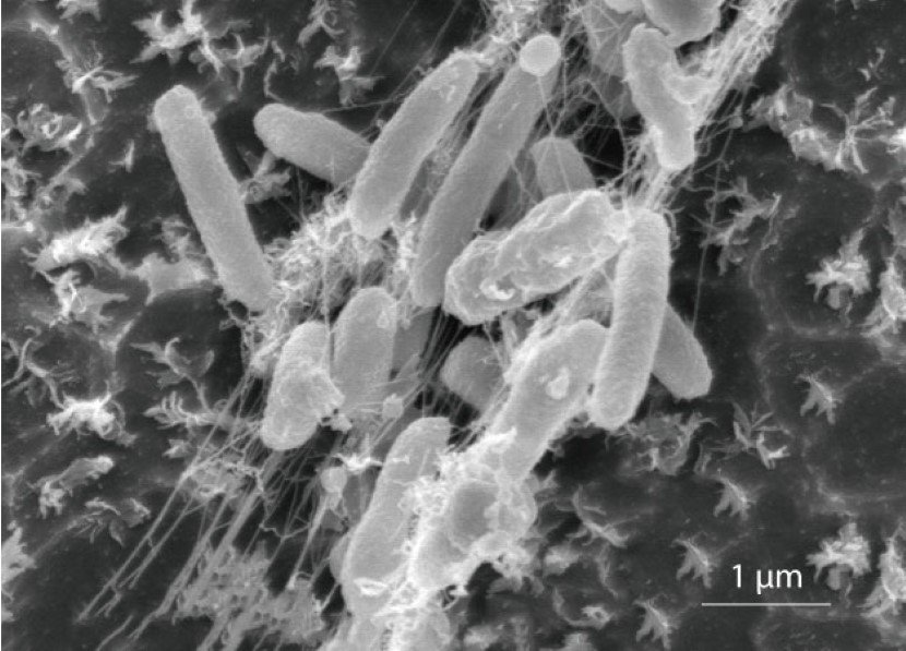 Ideonella sakaiensis Plastic Eating Bacteria